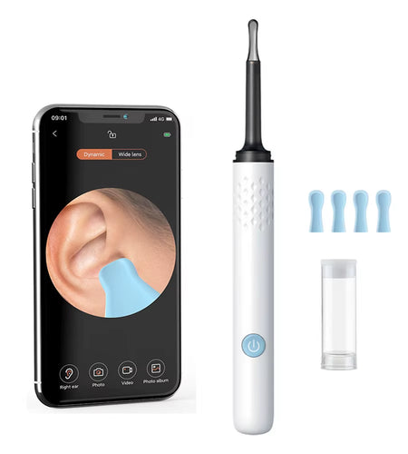 ClearView WiFi Ear Camera – HD Visual Ear Cleaner with LED Lights & Mini Earpick